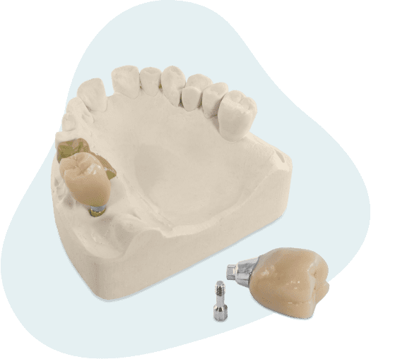 implantology1