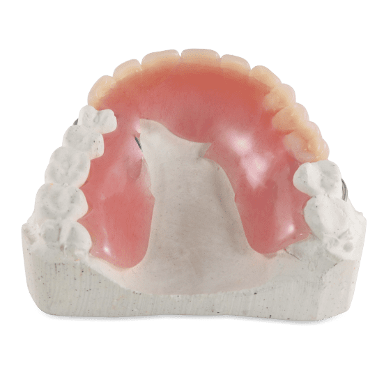 Denture Repair & Reline