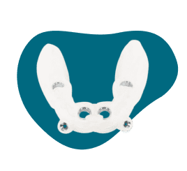 Surgical Guide Oceanic Dental