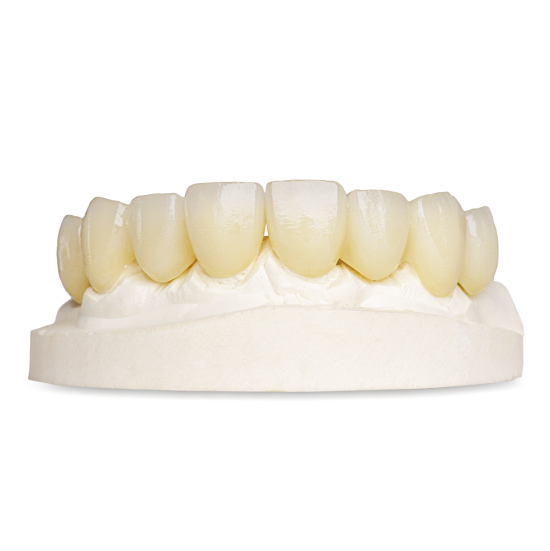 Zirconia on waxup Oceanic Dental Laboratory