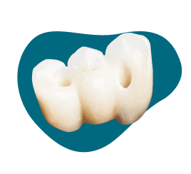 Screw-retained