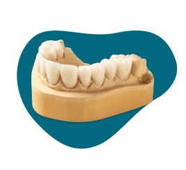 Veneers